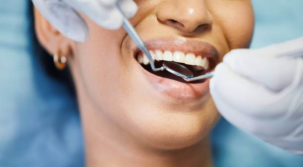 Best Emergency Dental Care for Sports Injuries in Taylors, SC
